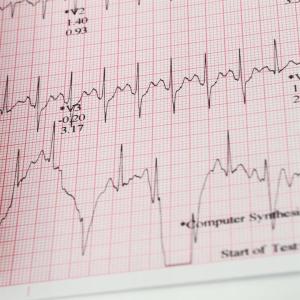 Tillbehör EKG