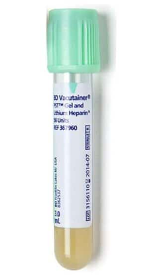 Vacutainer Vakuumrör Plast, Mintgrön Plasmaseparationsanalys PST II