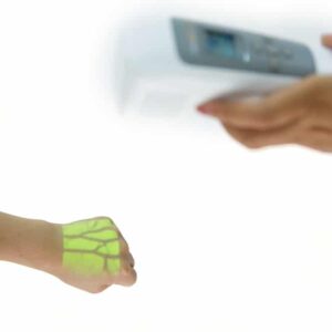 Vein Viewer VV-100 Venskanner