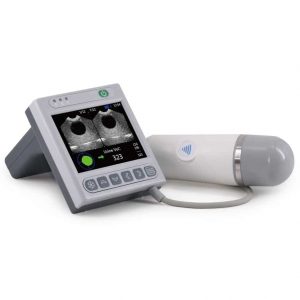 Visar portabel Bladderscanner BVT02 från MediStore